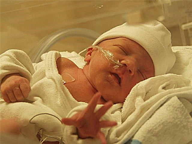 Zerebrale Ischämie bei einem Neugeborenen