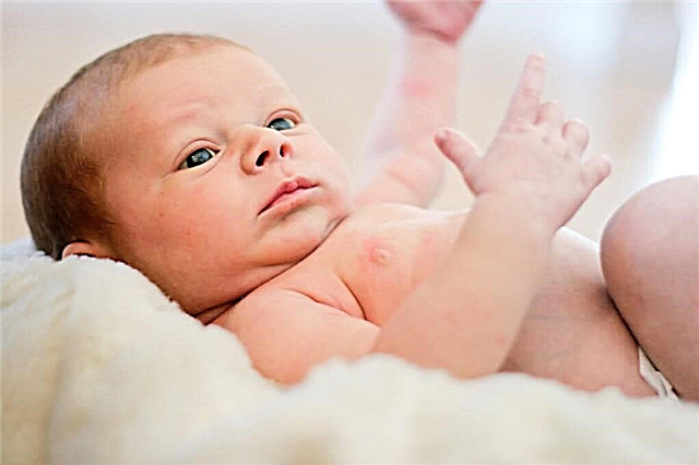 Hair or stubble on the back of a newborn: causes and methods of removal