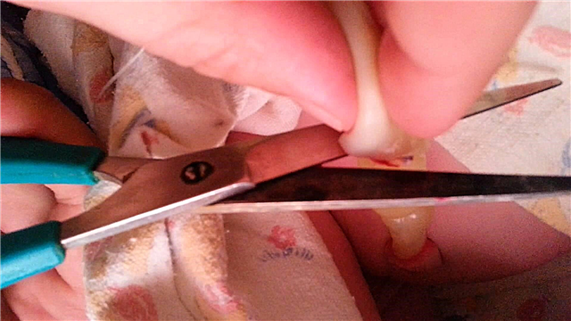 Cutting, bandaging, or clamping the umbilical cord after childbirth