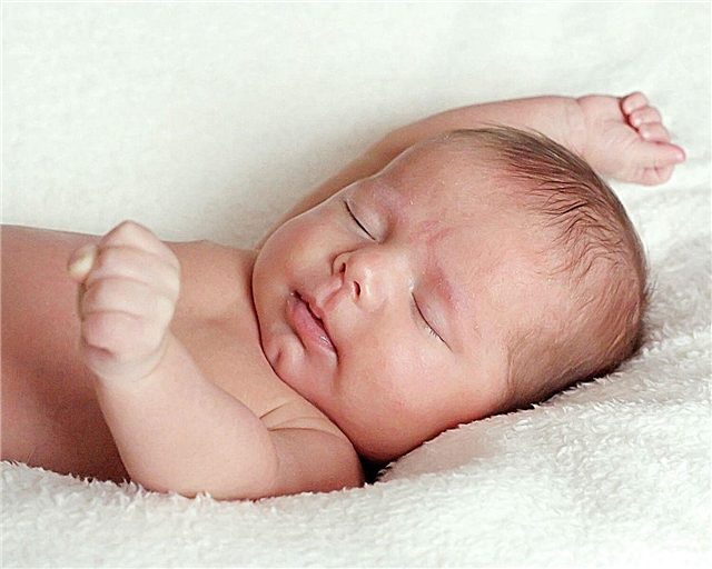 Edema cerebral em um recém-nascido 
