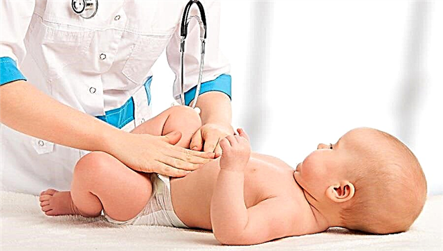 Stenoza pilorică la nou-născuți