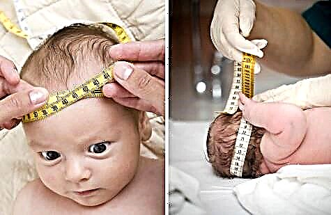 Hirndruck bei Säuglingen und Neugeborenen