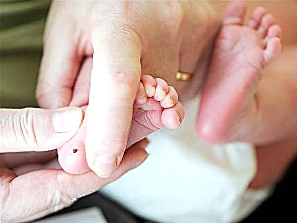 Triagem neonatal de recém-nascidos - análise genética do sangue do calcanhar