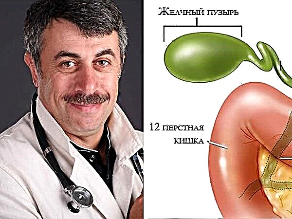 Dokter Komarovsky over problemen met de galblaas