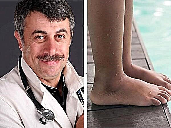 Liječnik Komarovsky o ravnim stopalima u djece