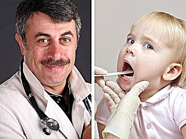 Dokter Komarovsky over chronische tonsillitis bij een kind