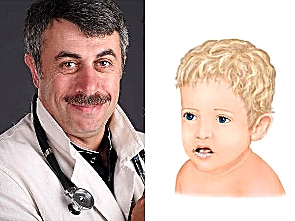 Lääkäri Komarovsky suuhun hoidosta lapsilla