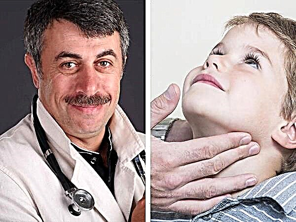 어린이 목의 림프절 비대에 관한 Komarovsky 의사
