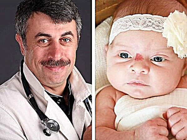 Zdravnik Komarovsky o hemangiomu pri novorojenčkih