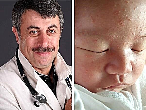 Dr. Komarovsky om akne hos nyfödda
