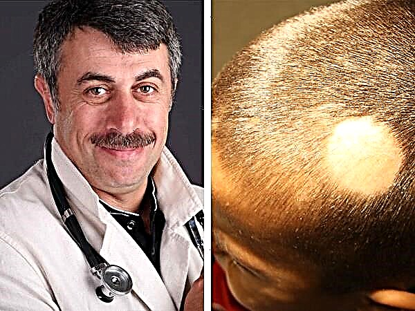 Dr. Komarovsky om orsakerna till håravfall hos barn