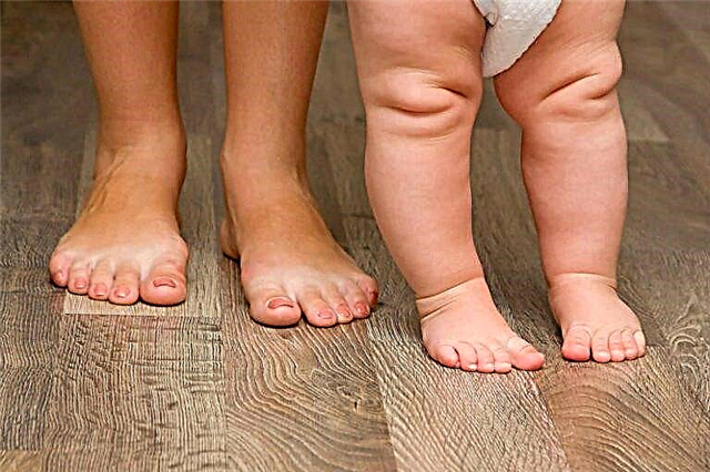 Massaggio ed esercizio fisico per il piede torto nei bambini