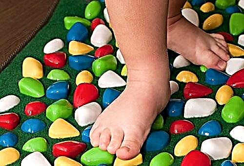 Prevention of flat feet in preschool children