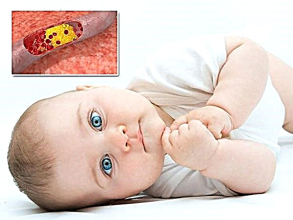 Hemofilia en niños