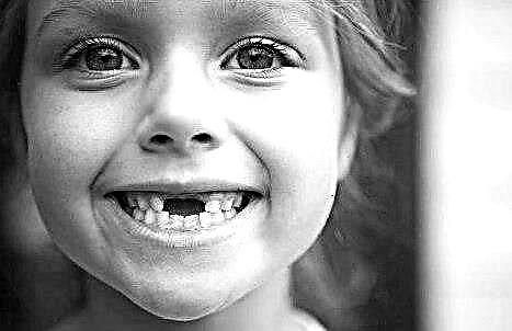 Схемата на загуба на млечни зъби при деца