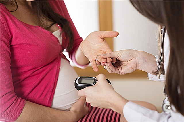 Glucose tolerance test during pregnancy