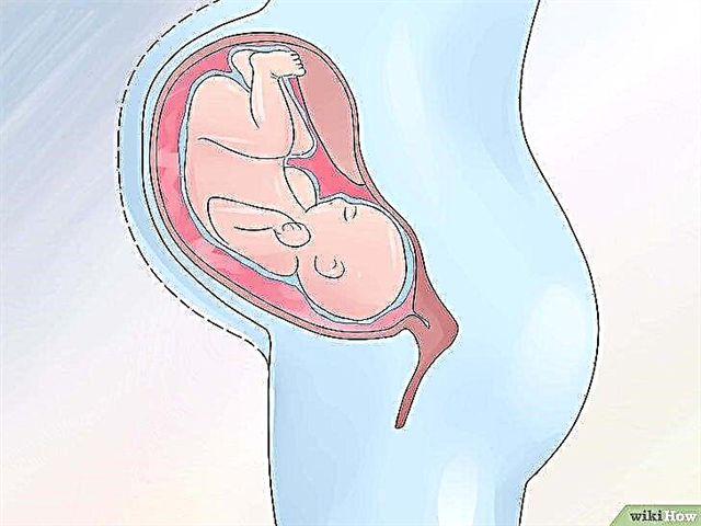 Indeks cecair amniotik: norma mengikut minggu dan penyebab penyimpangan