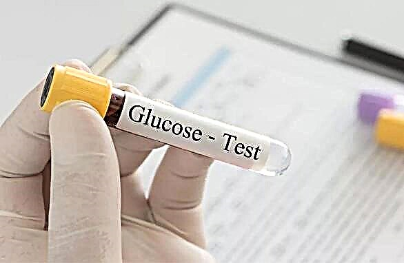 Hamilelikte glikoz tolerans testi
