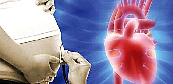 Kas ir hiperohoisks fokuss augļa sirds kreisajā kambarī un vai tas ir bīstams?