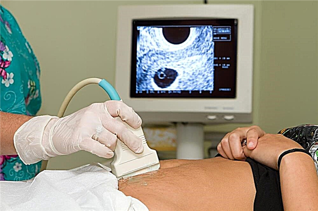 När börjar fostrets hjärta slå? När kan du höra ett hjärtslag eller se det på en ultraljudssökning?