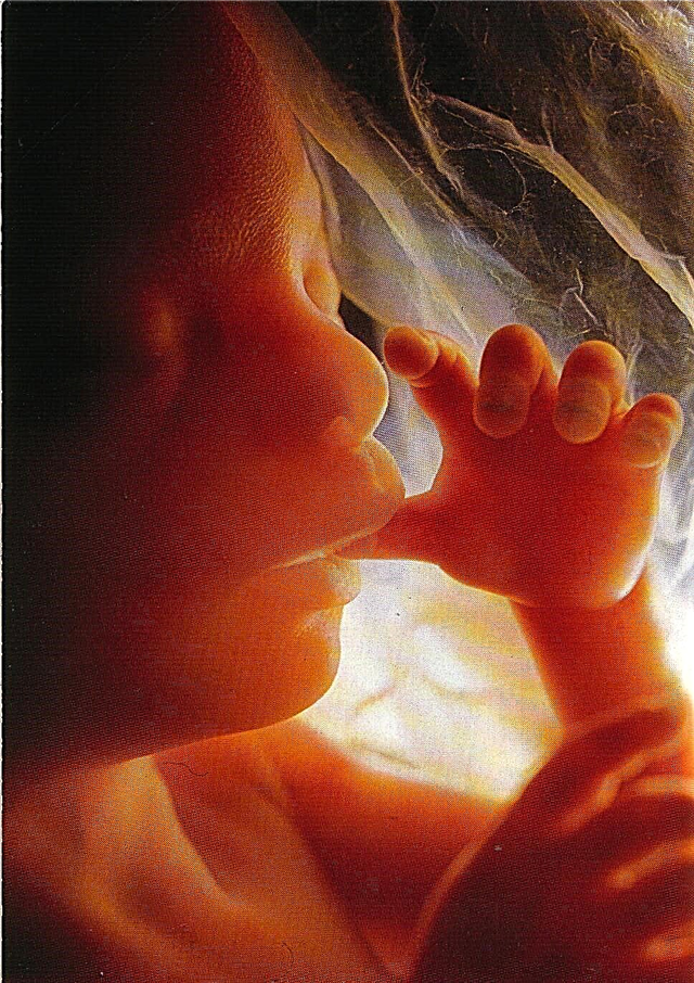 Un singolo intreccio del feto con il cordone ombelicale è pericoloso?