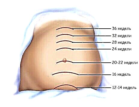 La altura del fondo del útero (VDM) y su dinámica por semanas de embarazo.