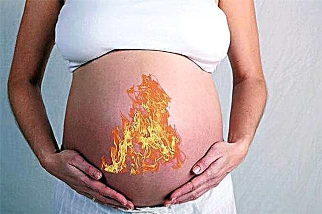 Pálení žáhy během těhotenství ve 3. trimestru