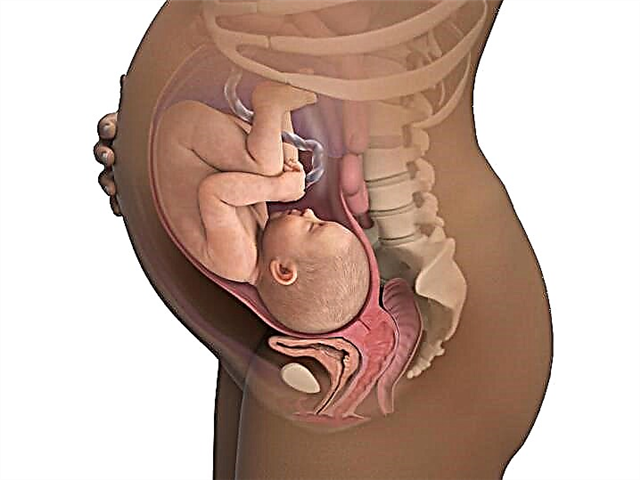 O que fazer com o tônus ​​uterino no 3º trimestre da gravidez?