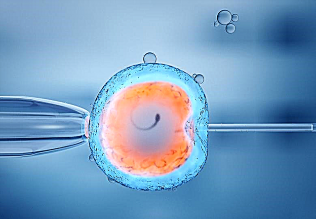 Якщо ви зважилися на ЕКЗ: як поліпшити якість яйцеклітин і збільшити шанси на зачаття?