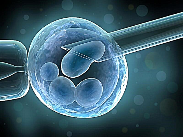 Prečo sa po IVF môže objaviť menštruácia?