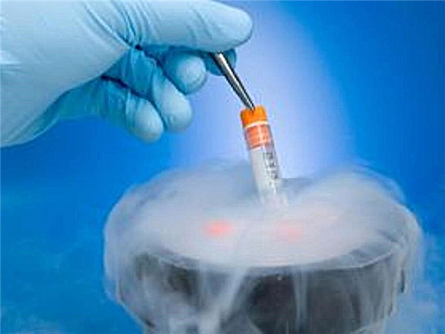 Was ist Embryokryokonservierung und warum wird sie benötigt?