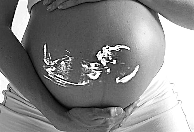 Hematomos diagnozė ir gydymas gimdoje nėštumo metu