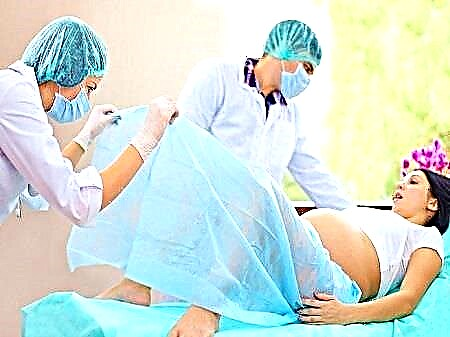 Bevalling na 33 weken zwangerschap