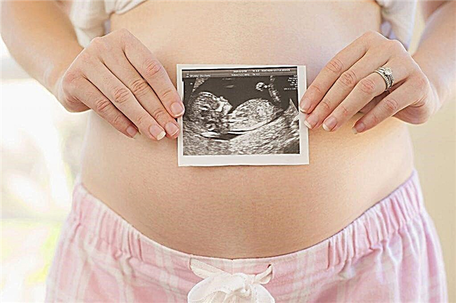 Porod ve 29. - 31. týdnu těhotenství