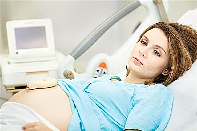 Gimdymas 35 nėštumo savaitę