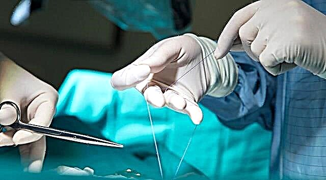 Funktioner ved suturheling efter episiotomi og løsning af mulige problemer