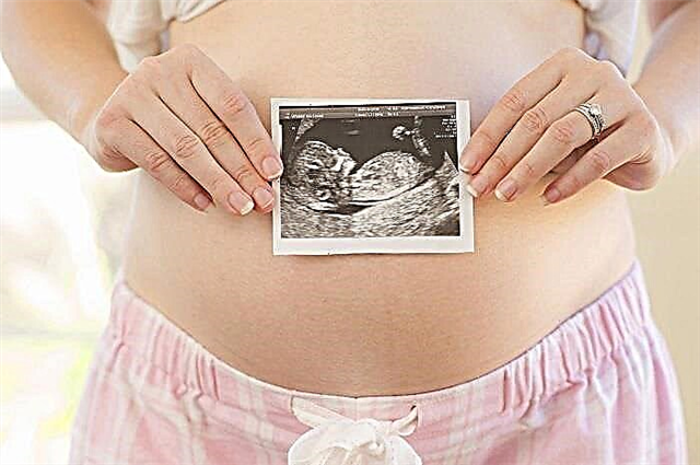 Förlossning vid 32 veckors graviditet
