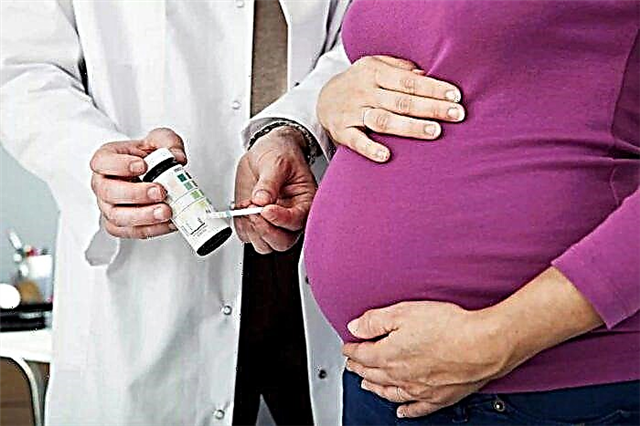 Acetone and ketone bodies in urine during pregnancy