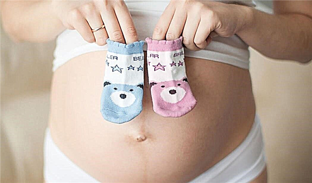 Kurā nedēļā jūs varat uzzināt bērna dzimumu ar ultraskaņu?