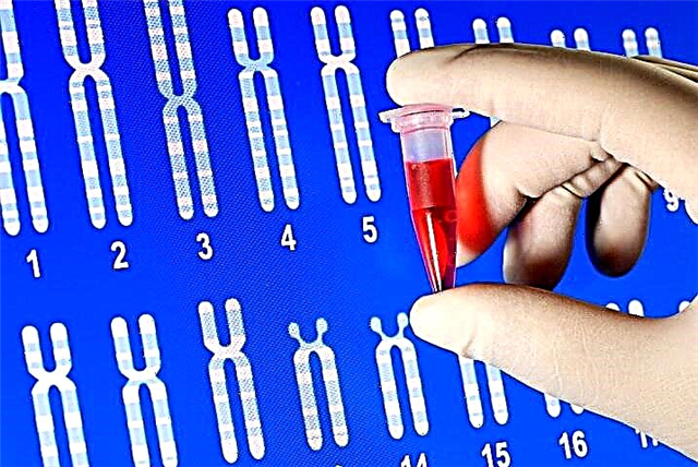 Mi az a nem invazív prenatális DNS-teszt, és miért végezzük terhesség alatt?