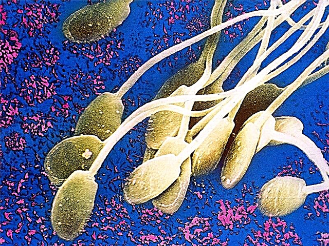 Kako djeluju stanice sperme? Njihove značajke, struktura, veličina i funkcija