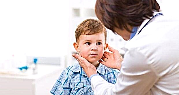 Hyperthyroidism in children