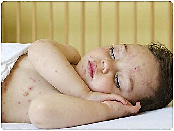 O que indicam as manchas na pele da criança?