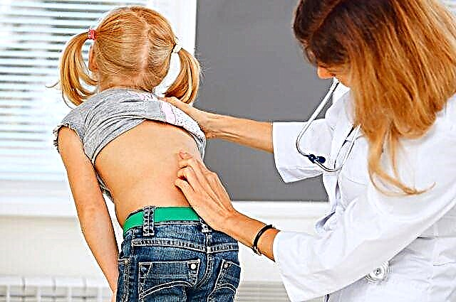 Mit jeleznek a gyermek hátán található piros foltok és mit kell tenni?