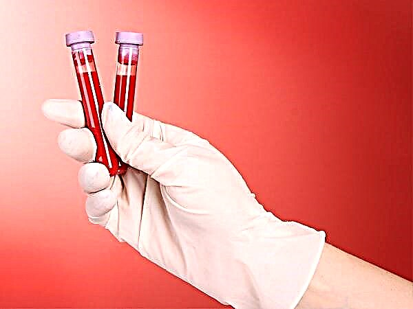 Serologisk blodprøve for hepatitt, HIV, syfilis og andre sykdommer