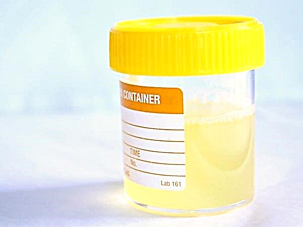 Analiza urina u djece prema Zimnitsky