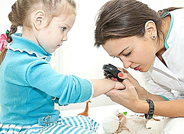 أعراض وعلاج الصدفية عند الأطفال
