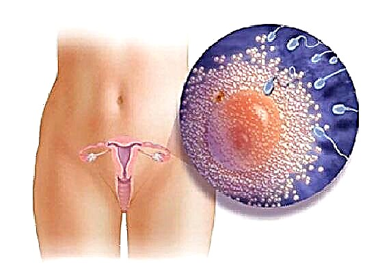 Quali sono le secrezioni dopo l'ovulazione, se il concepimento è avvenuto?