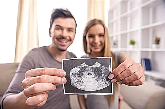 Pemeriksaan ultrasound pada trimester pertama: syarat dan norma