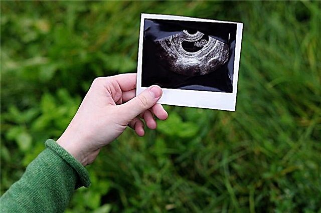 الموجات فوق الصوتية في 4 أسابيع من الحمل